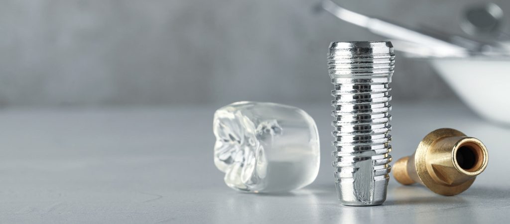 Οδοντιατρικά Μέταλλα